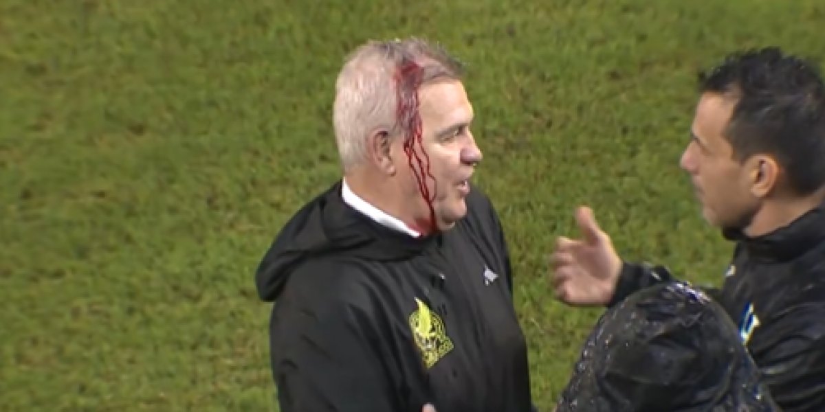 Treinador mexicano deixa campo sangrando após ser agredido por torcedores