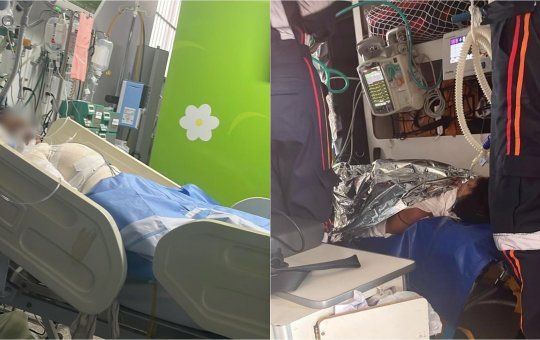 Adolescente tem corpo queimado enquanto dormia em Salvador