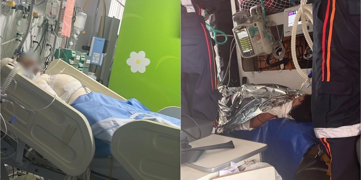 Adolescente tem corpo queimado enquanto dormia em Salvador