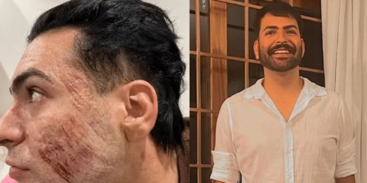 Mãe de empresário morto após fazer peeling de fenol pede indenização milionária