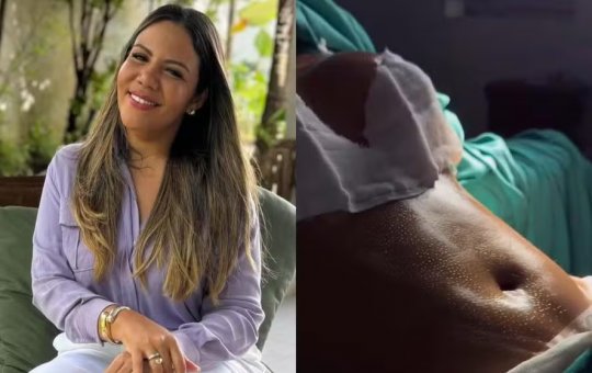 Mani Reggo compartilha resultado de procedimentos estéticos: 'Mudança de vida'