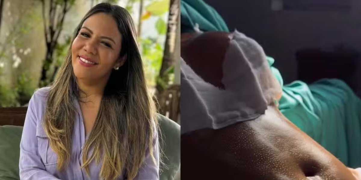 Mani Reggo compartilha resultado de procedimentos estéticos: 'Mudança de vida'