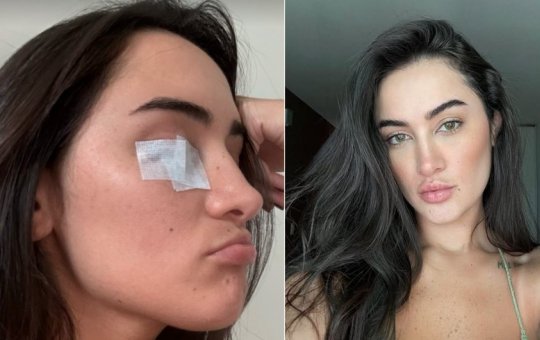 Gabi Melim descobre doença por causa da ansiedade