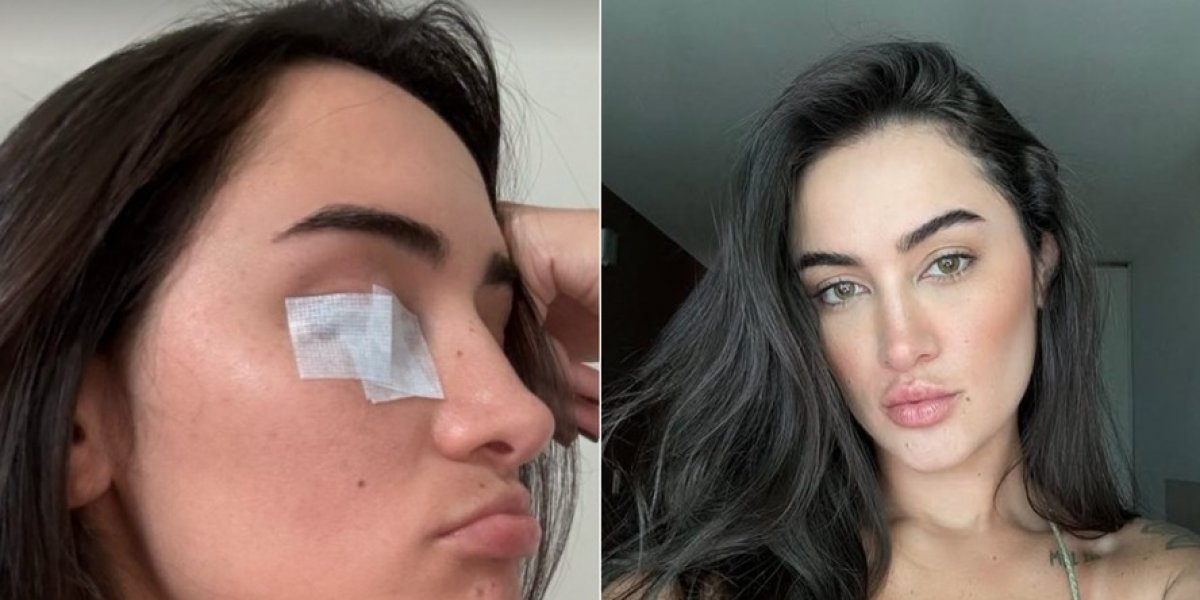 Gabi Melim descobre doença por causa da ansiedade