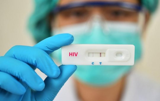 O lento avanço na batalha contra o HIV e a AIDS
