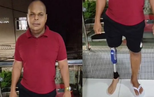 Subtenente da PM, que amputou perna após ser baleado em serviço, recebe prótese e agradece ao governador Jerônimo Rodrigues