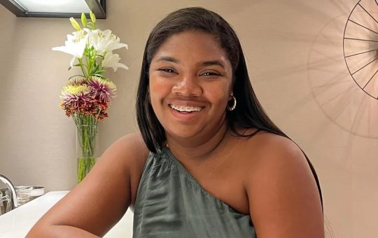 Raquel Brito compartilha transformação corporal após procedimento estético