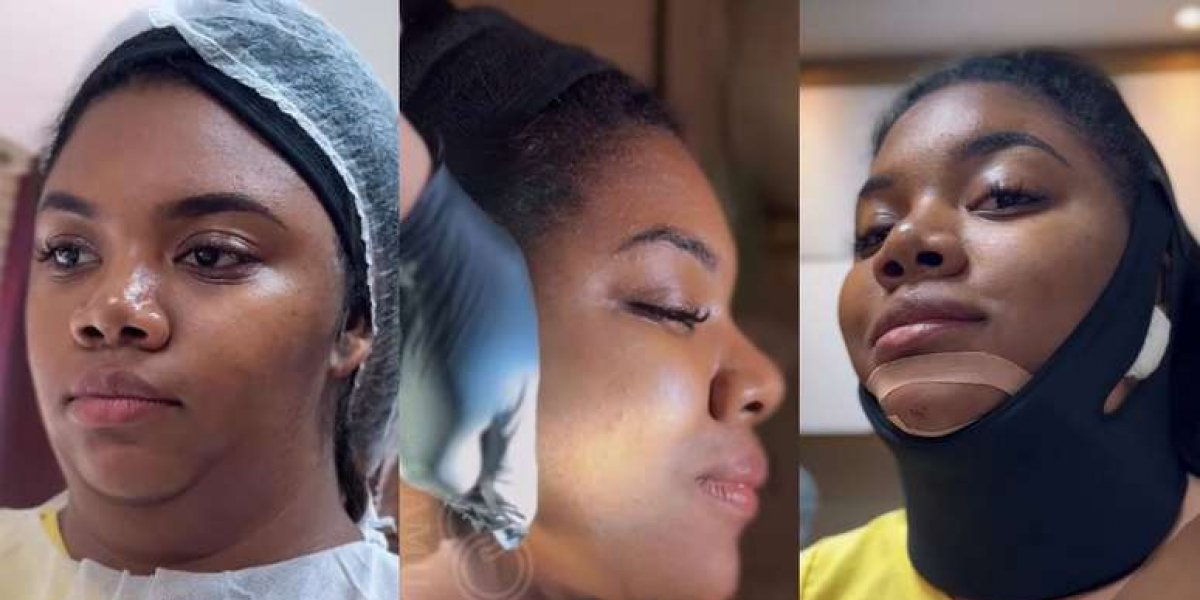 Raquel Brito passa por cirurgia para retirar a papada: 'Sonho Realizado'