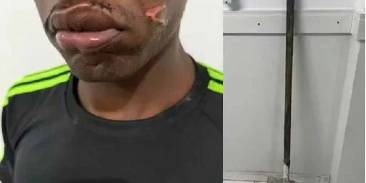 Mulher agride companheiro com golpes de pá por chegar tarde em casa