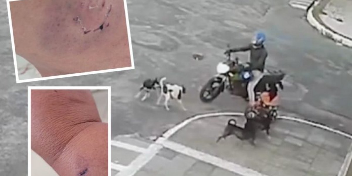 Agente de saúde é atacada por seis cães no interior da Bahia