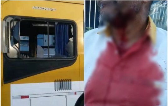 Motorista de ônibus é agredido com pedrada no rosto após desentendimento com passageiro em Salvador