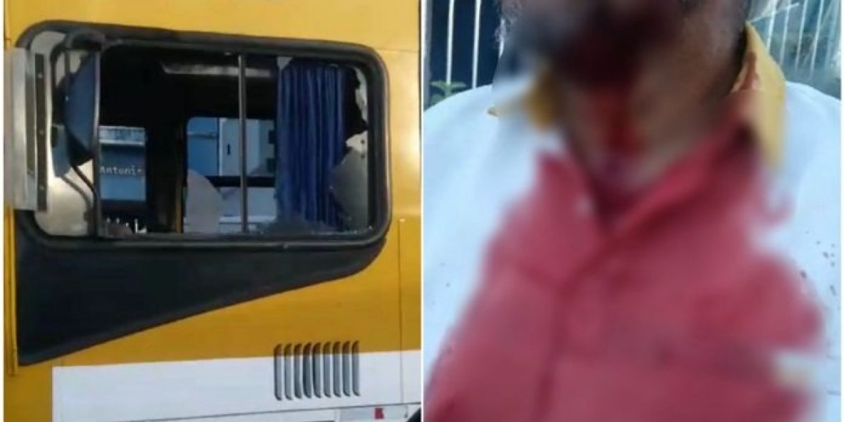 Motorista de ônibus é agredido com pedrada no rosto após desentendimento com passageiro em Salvador
