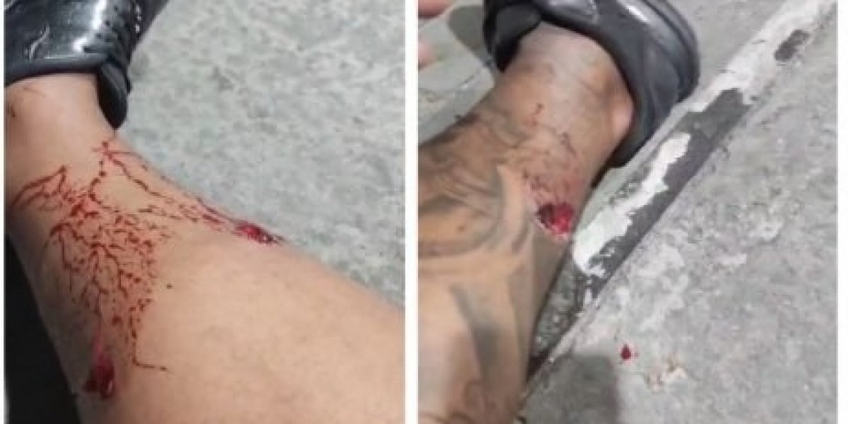 Mototaxista é baleado em tentativa de assalto por falso passageiro