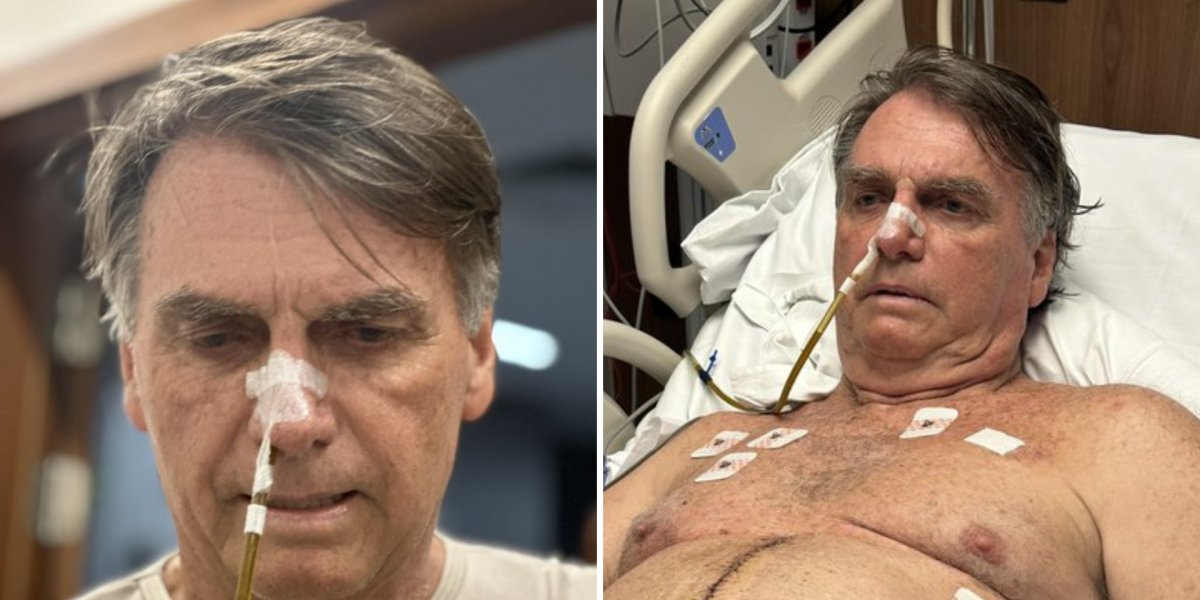 Bolsonaro tem seus drenos abdominais retirados, mas segue sem previsão de alta