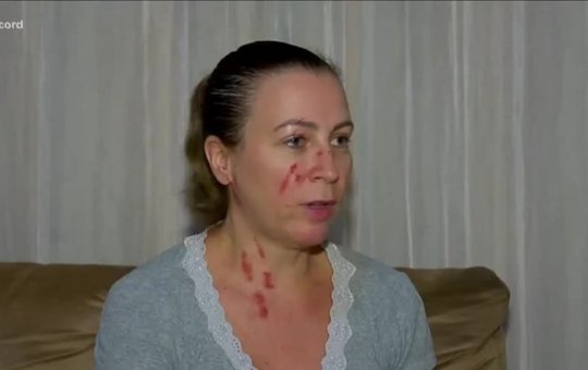 Enfermeiras são vítimas de agressão em posto de saúde de São Paulo