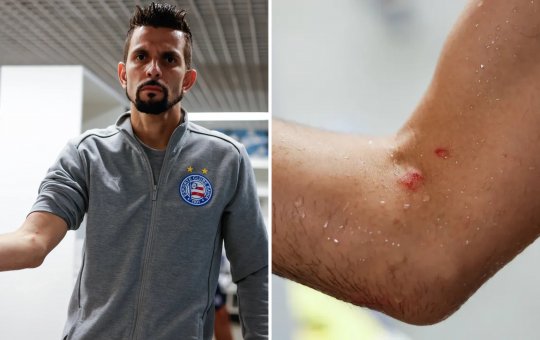 Bahia manifesta insatisfação com arbitragem e solicita posicionamento da CBF