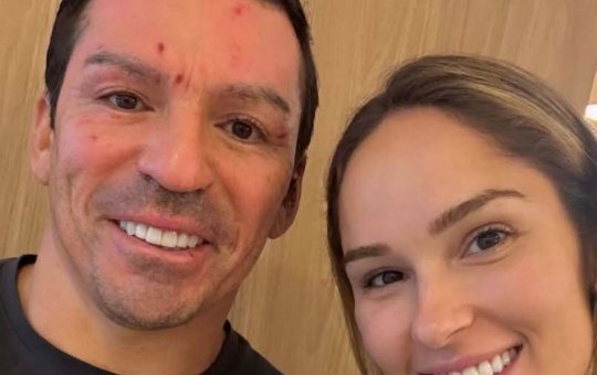 Ex-jogador Lúcio mostra rosto pela primeira vez após acidente doméstico