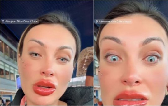 Andressa Urach se desespera e se arrepende por mudança na cor dos olhos: 'orem por mim'