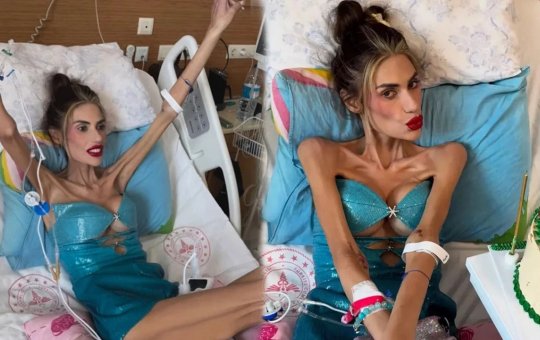 Influenciadora turca morre com 22 kg após pressão estética; família e entidades protestam