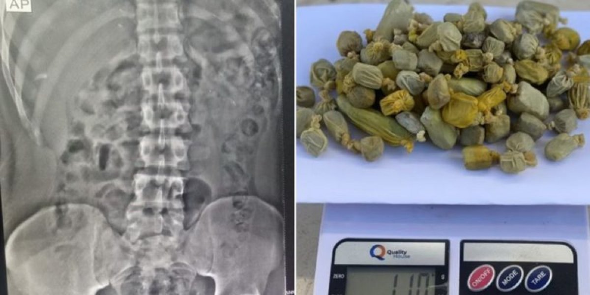 Foto do body scanner / Foto das drogas apreendidas