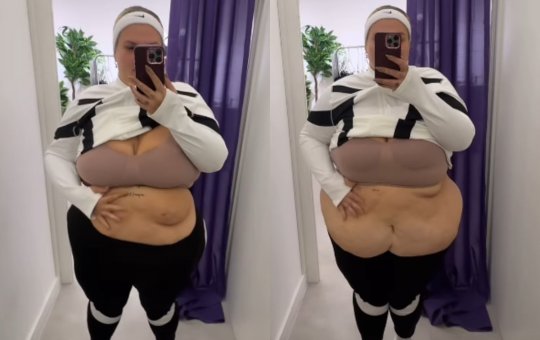 Thais Carla exibe excesso de pele após perder mais de 50 kg