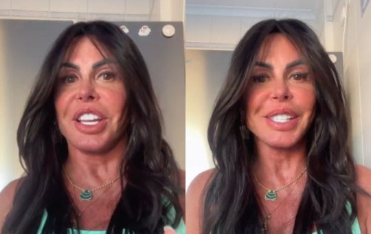 Gretchen aparece com novo rosto após procedimento de harmonização