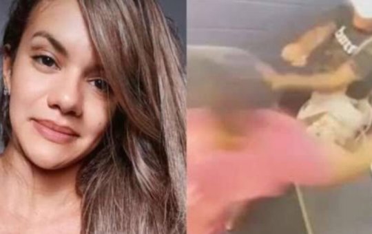 Juliana Soares passa por reconstrução facial após agressão brutal com 61 socos