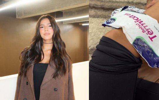 Duda Guerra revela por que recusou cirurgia para remover tumor no joelho