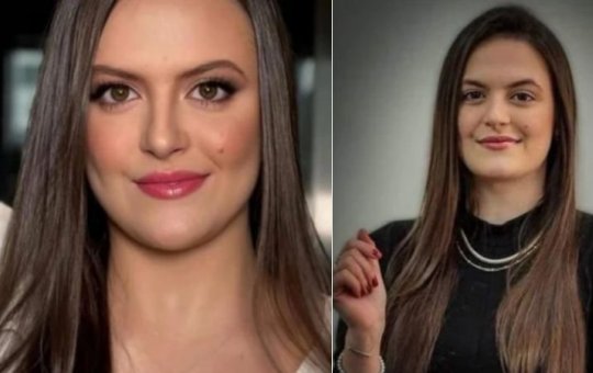 Jovem morre após sofrer reação alérgica grave em tomografia com contraste