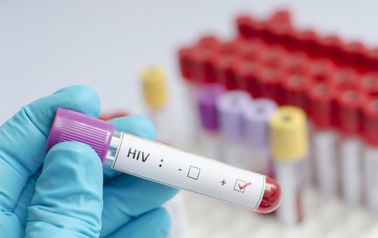 Sesab desmente informações de que 11 mil jovens estariam infectados com HIV na Bahia