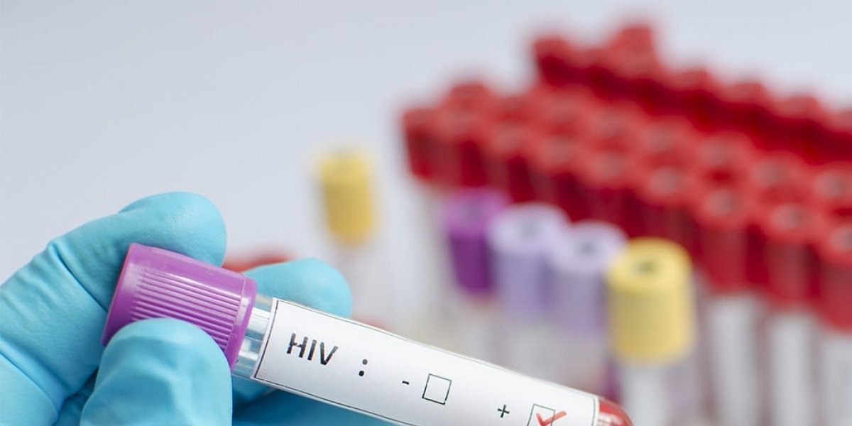 Sesab desmente informações de que 11 mil jovens estariam infectados com HIV na Bahia
