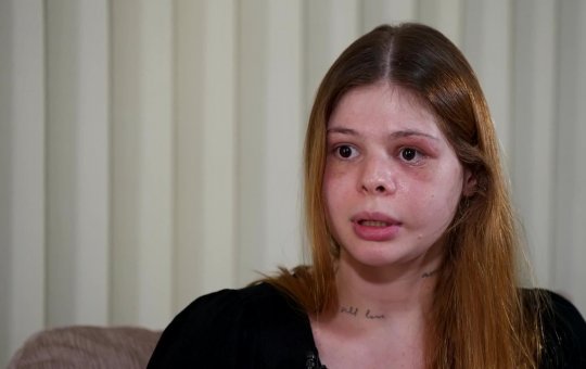 Após 12 dias na UTI, médica agredida por fisiculturista quebra o silêncio