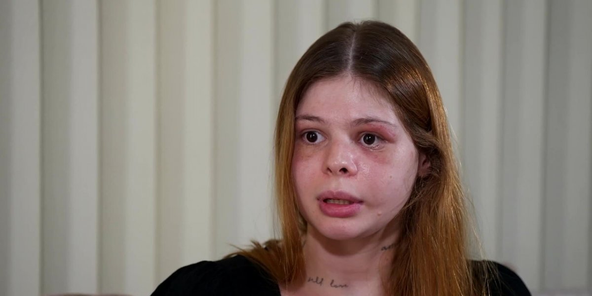 Após 12 dias na UTI, médica agredida por fisiculturista quebra o silêncio