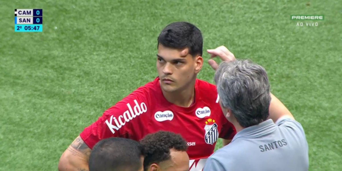Goleiro do Santos leva joelhada na cabeça e deixa jogo de ambulância
