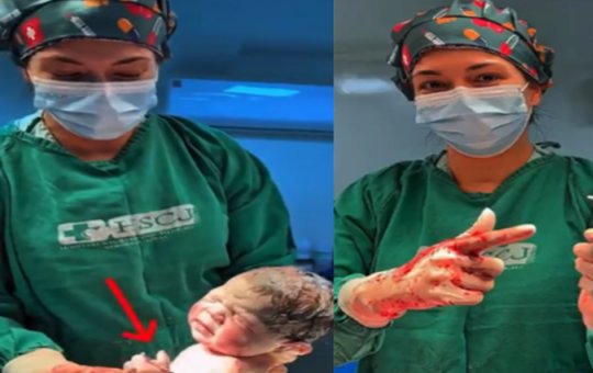Médica compartilha vídeo de bebê segurando DIU após parto: 'Troféu de vitória'