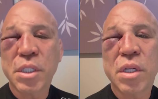 Wanderlei Silva se defende, expõe áudios de Popó e dispara: 'Fui covardemente agredido'