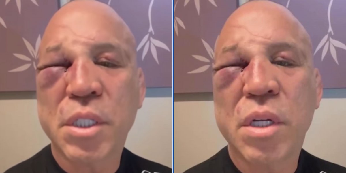 Wanderlei Silva se defende, expõe áudios de Popó e dispara: 'Fui covardemente agredido'