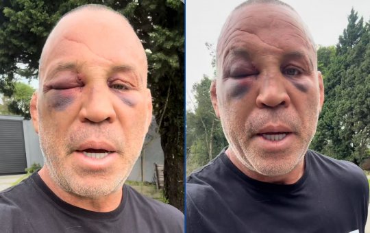 Wanderlei Silva desabafa novamente nas redes sociais e promete ir à justiça contra filho de Popó