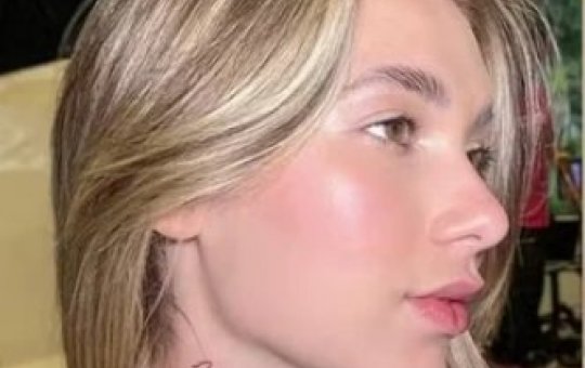Virginia aparece com curativo no local onde tinha nome de Zé Felipe tatuado