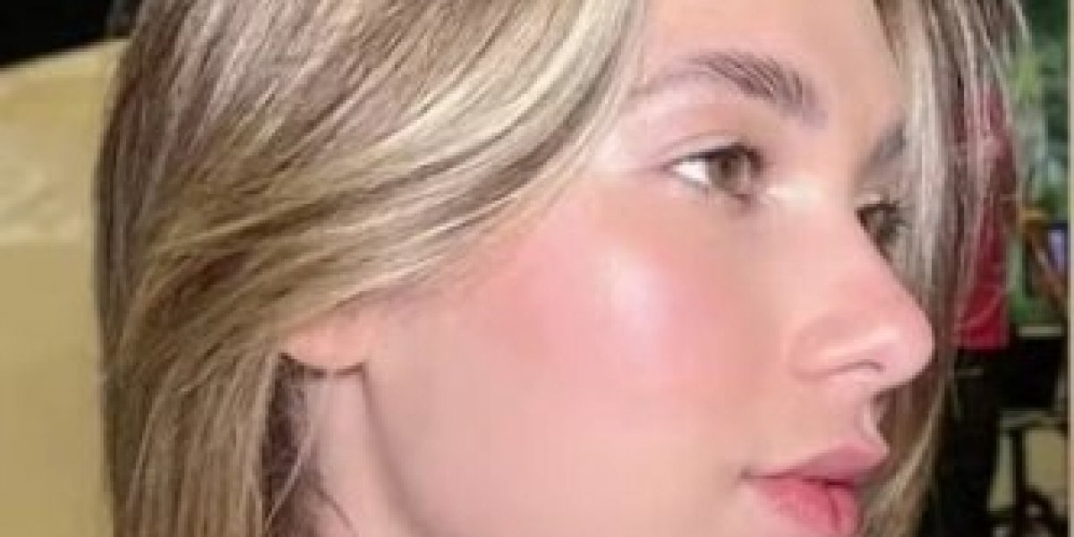 Virginia aparece com curativo no local onde tinha nome de Zé Felipe tatuado
