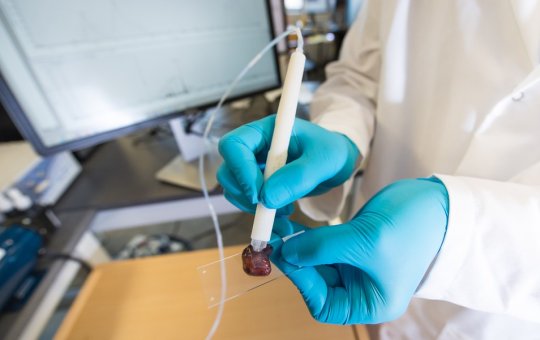 Caneta que detecta câncer começa fase de testes no Brasil 