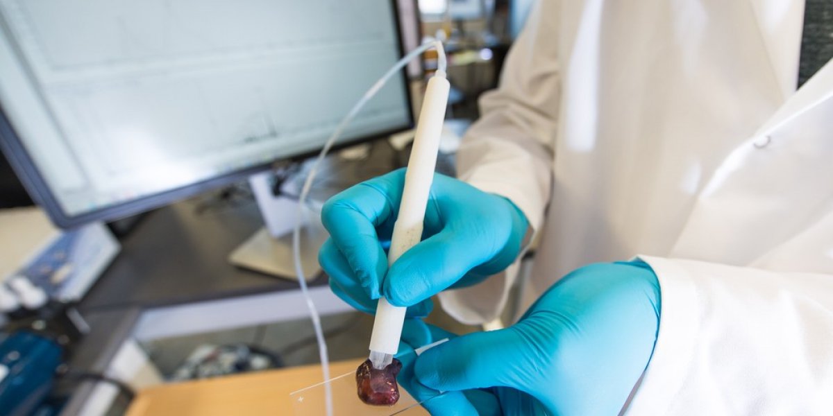 Demonstração de uso da caneta MasSpec em uma amostra de tecido humano