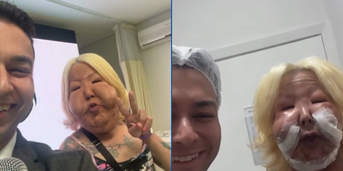 A influenciadora Juju do Pix realizou uma cirurgia