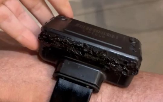 Bolsonaro acreditava que tornozeleira eletrônica tinha escuta e alega ter tido um “surto” 