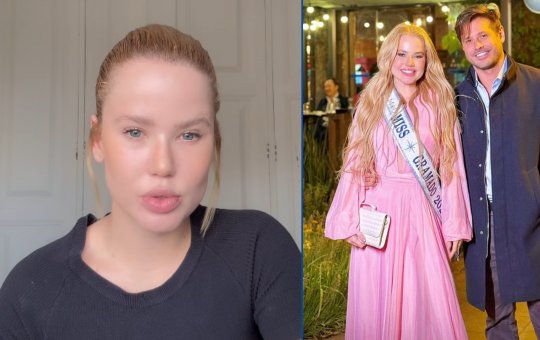 Marcela Tomazewski, ex de Dado Dolabella, diz que negou agressões por "vergonha e medo"