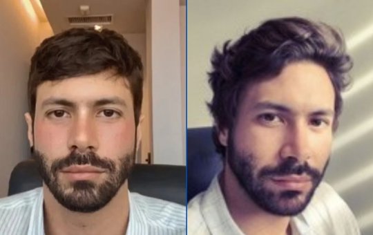 Psiquiatra encontrado morto em Salvador pode ter sofrido overdose, aponta laudo