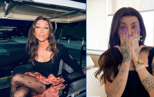 Maya Massafera exibe mudanças no rosto após cirurgia para remover ossos do maxilar