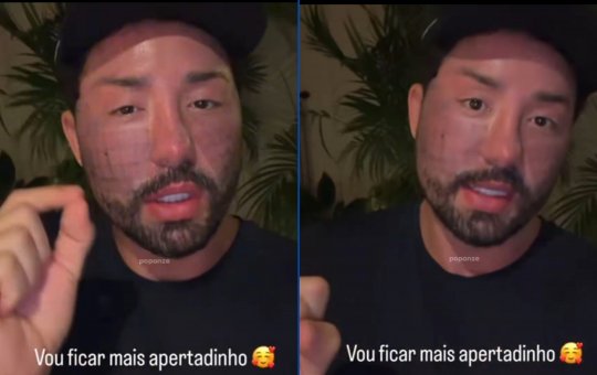 Rico Melquiades revela sua próxima cirurgia: 'Quero ficar mais apertado'