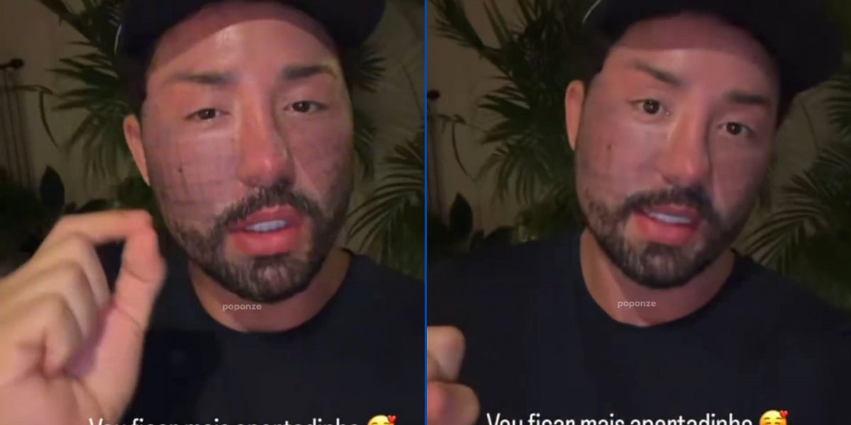 Rico Melquiades revela sua próxima cirurgia: 'Quero ficar mais apertado'