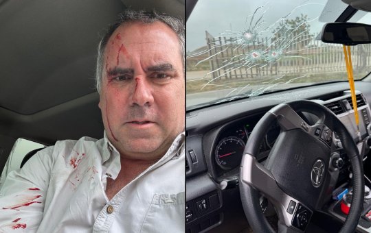 Pré-candidato à presidência do Peru é alvo de ataque a tiros